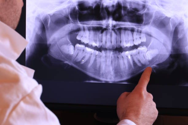 Best Broken or Chipped Tooth Repair in Belleville, KS