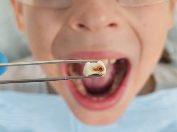 Best Emergency Care for Gum Disease in Belleville, KS